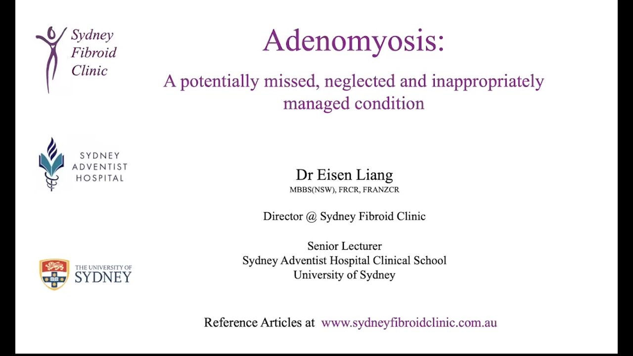Adenomyosis: A potentially missed, neglected and inappropriately managed condition.