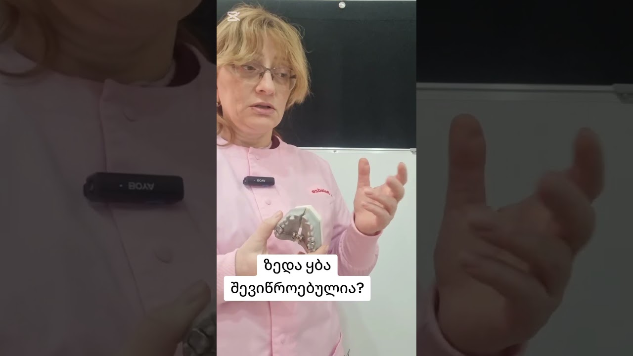 ასიმეტრია, ზედა ყბის შევიწროება