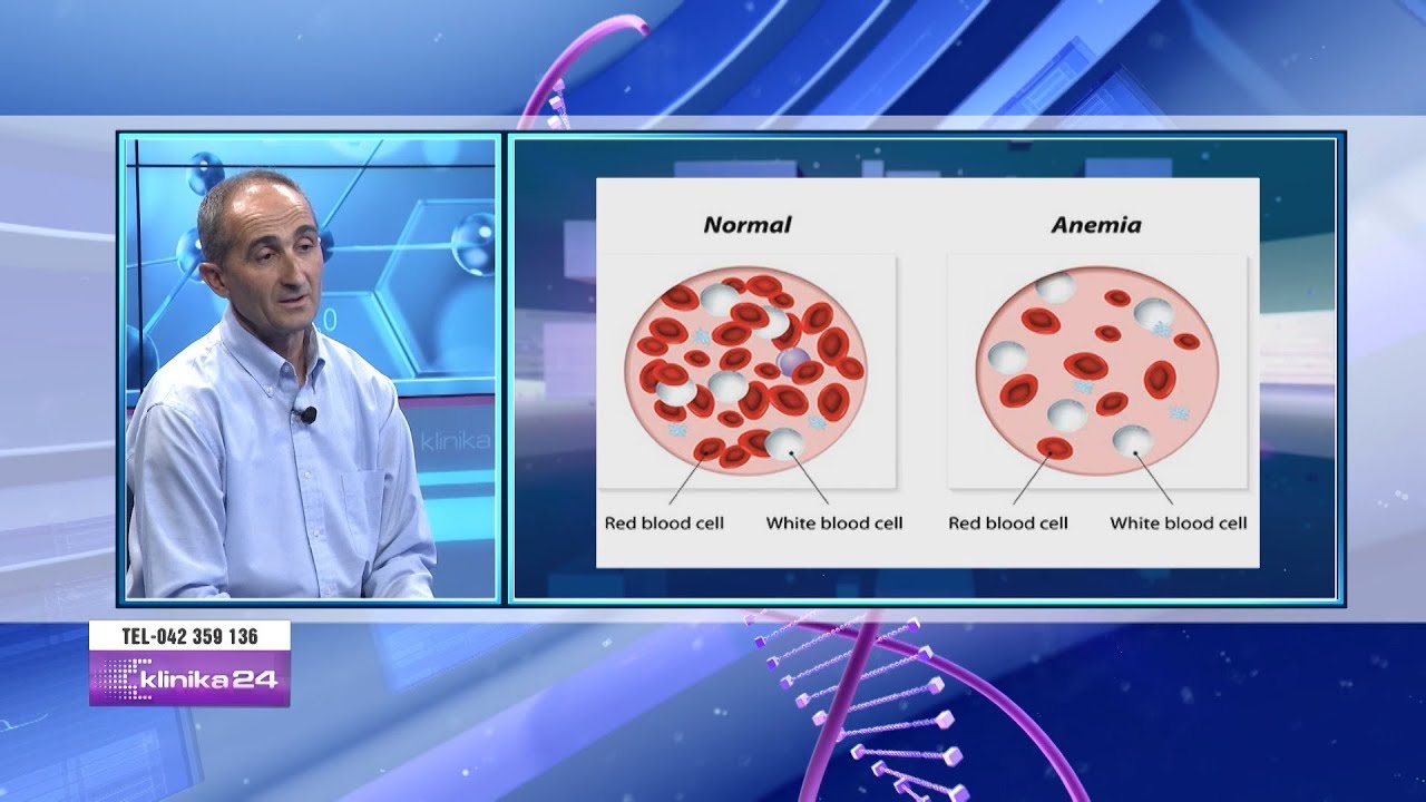 Anemia… sa e rëndësishme është të gjendet shkaku dhe të ndiqet kura e duhur