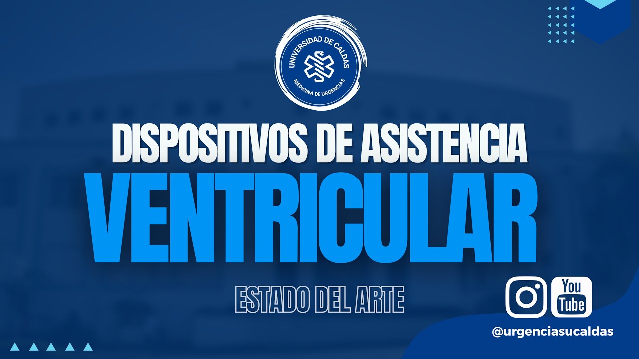 Dispositivos de asistencia ventricular - Dr. Jose Luis Olivera (Estado del arte)