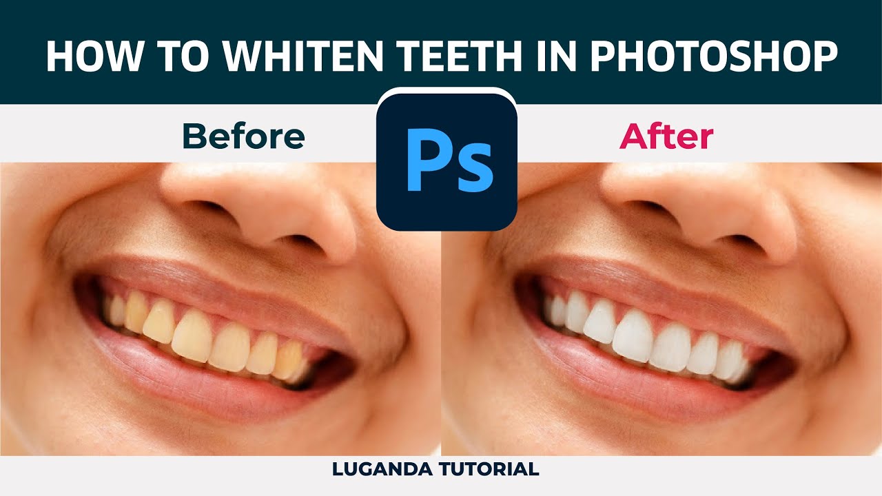 How to Whiten Teeth With Adobe PHOTOSHOP  || Luganda Tutorial