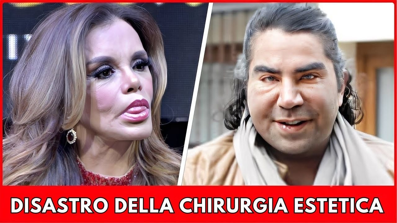TOP 7 peggiori interventi di chirurgia estetica delle star latinoamericane–trasformazioni scioccanti