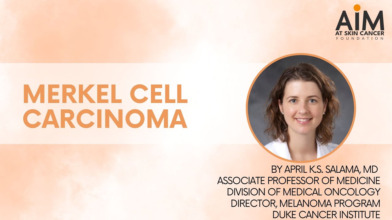 Understanding Merkel Cell Carcinoma