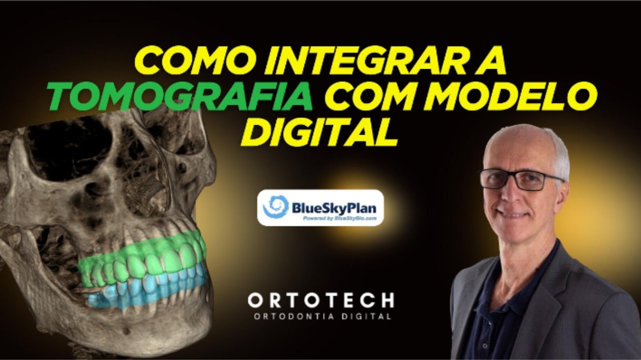 Integração de Tomografia com Modelo Digital no Blue Sky Plan