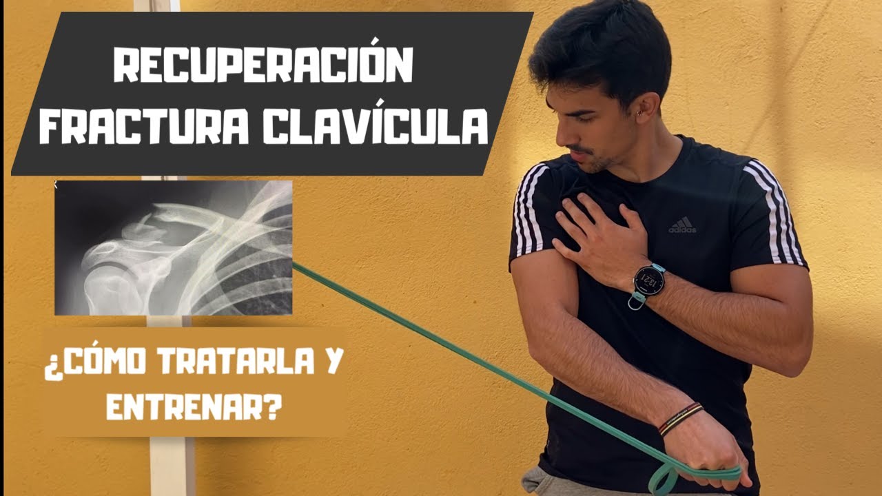 RECUPERACIÓN DESPUÉS de una  ROTURA : FRACTURA de CLAVÍCULA