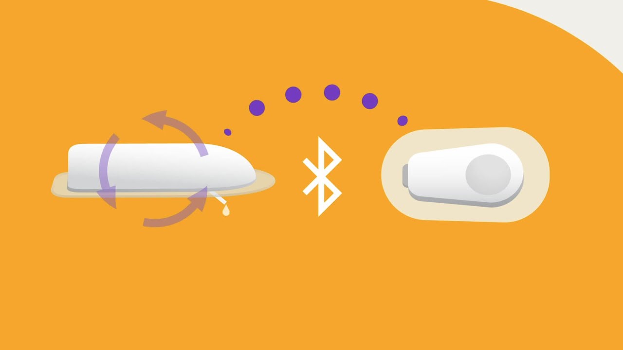 Omnipod&reg; - Automated Insulin Delivery (AID) Systems
