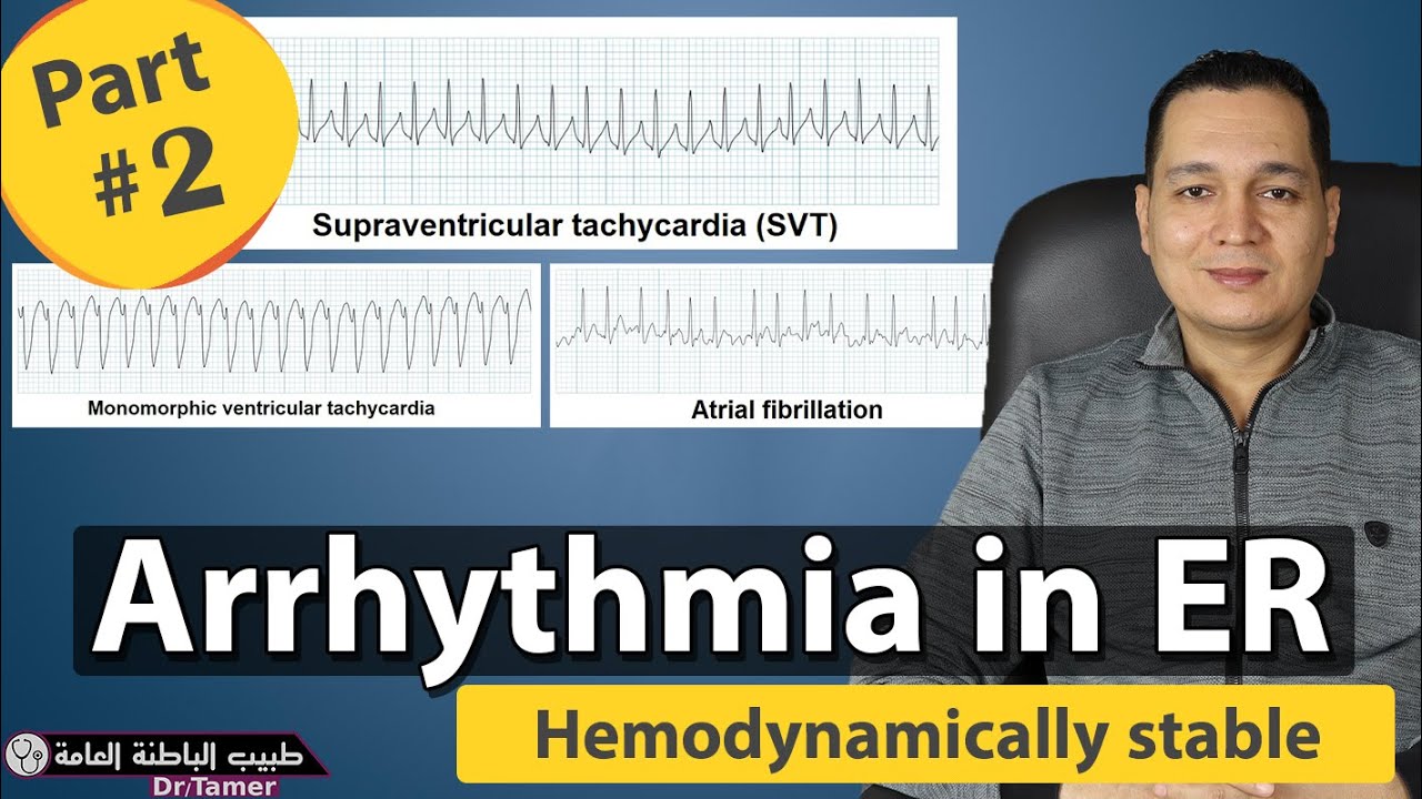 Arrhythmia in ER part 2 - hemodynamically stable patients/ اختلال ضربات القلب فى الطوارئ - الجزء 2
