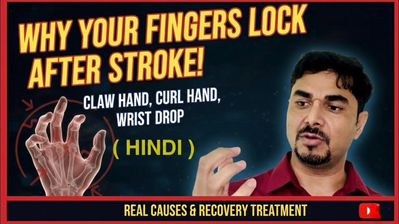 Stroke Hand Problems: claw hand,Fingers Curl, Lock or Drop – Treatment & Recovery. Stroke recovery