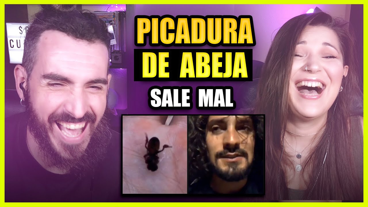 👉 REACCIÓN PICADURA DE ABEJA TERMINA MAL | Somos Curiosos