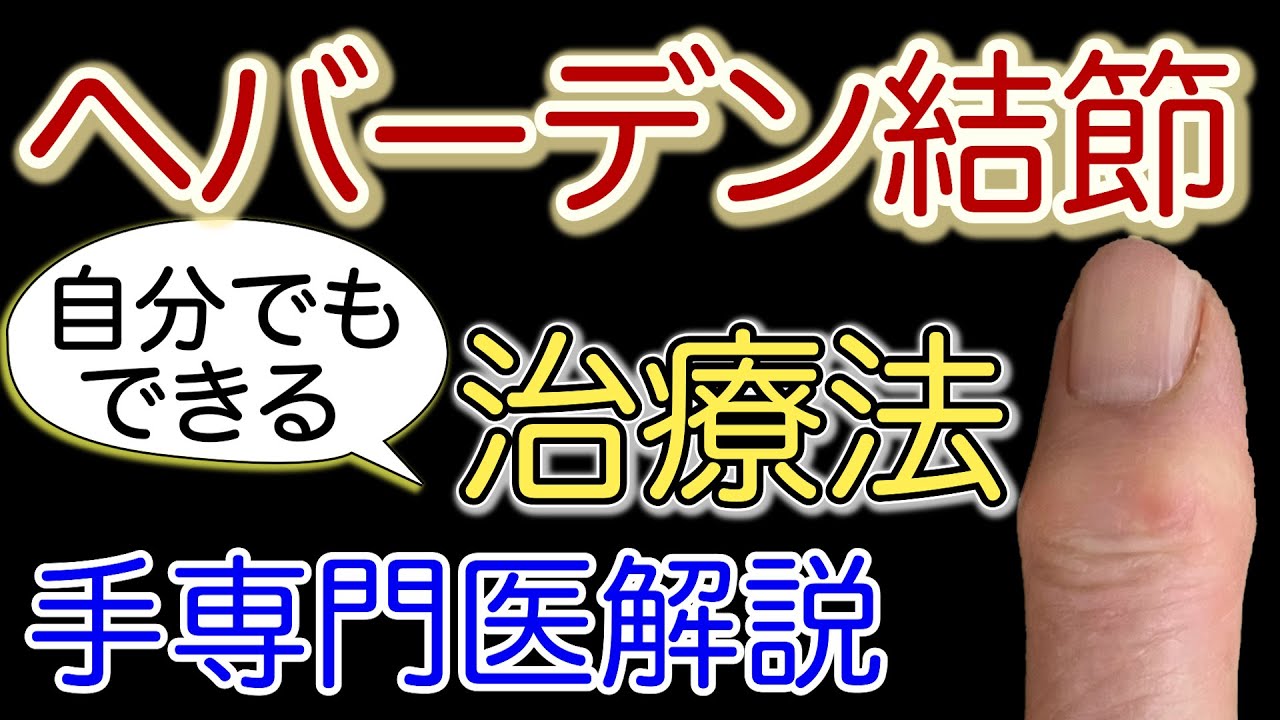 【手専門医解説】ヘバーデン結節の治療法