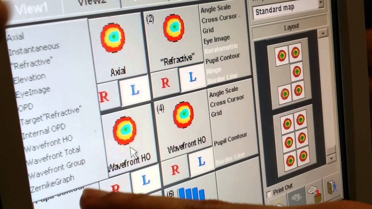 شرح طريقة استخدام جهاز التوبوغرفي 2 (OPD)
