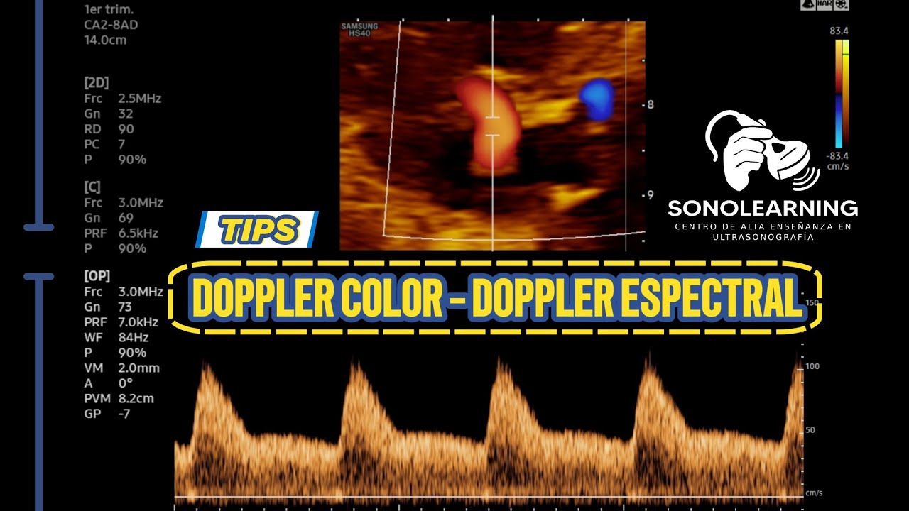 DOPPLER COLOR - DOPPLER ESPECTRAL