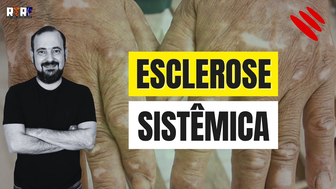Esclerose sistêmica | José Góes
