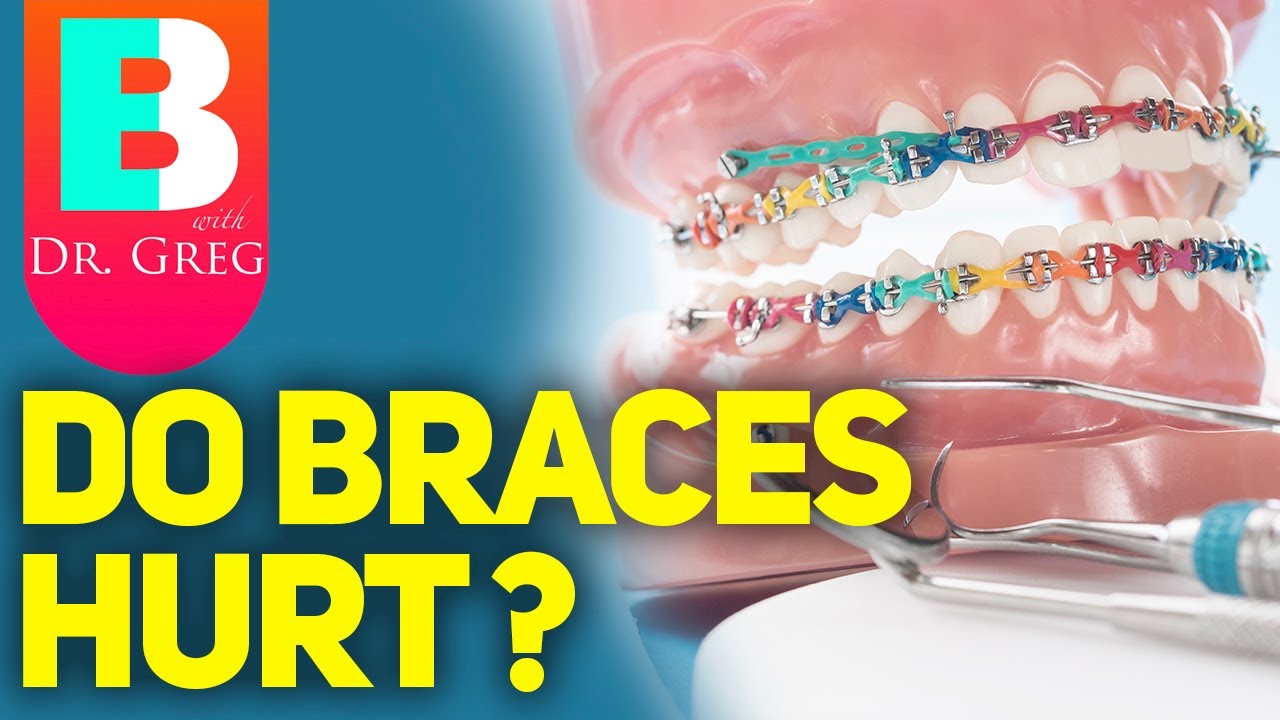 Do Braces Hurt?