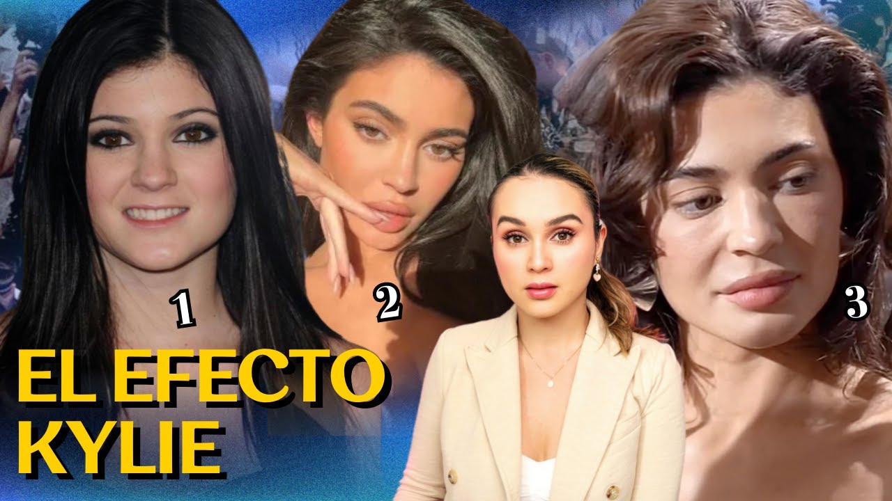 La Transformación de KYLIE JENNER y las consecuencias de los RELLENOS FACIALES #dossierperfume