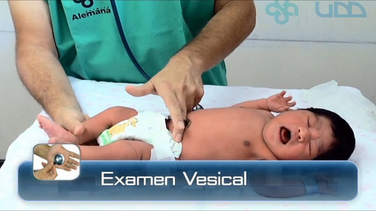 🌟EXAMEN VESICAL DEL RECIÉN NACIDO🌟