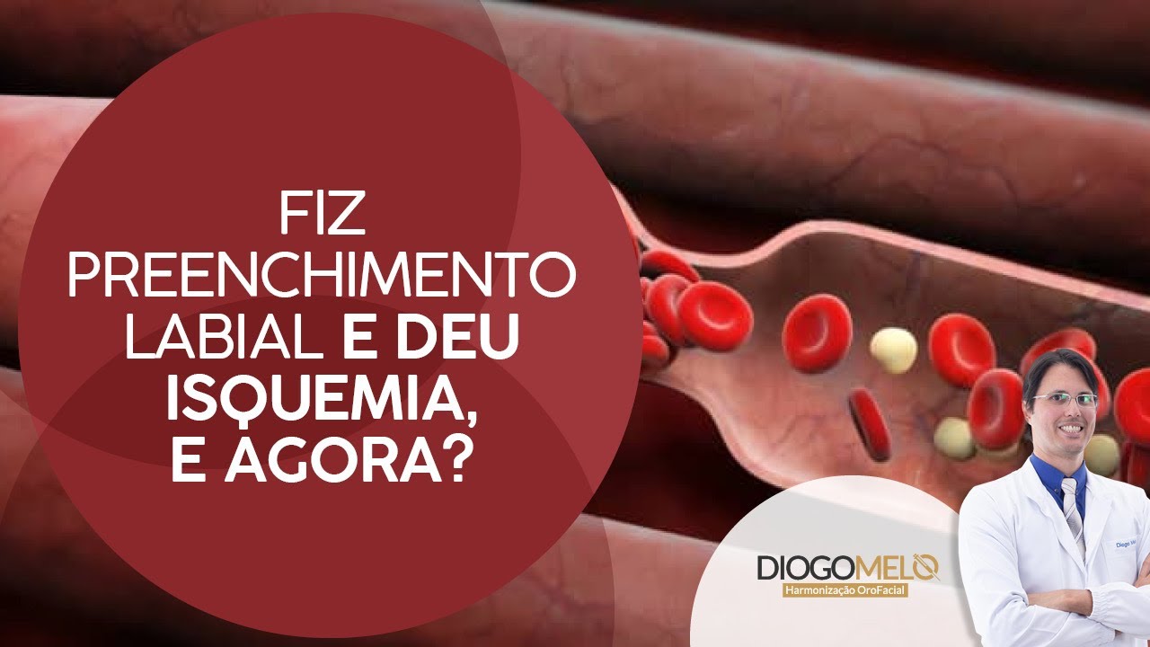 Fiz Preenchimento Labial e deu Isquemia, e agora?