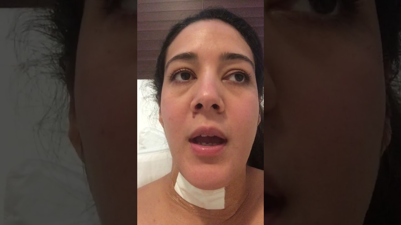Experiencia cirugía reemplazo de disco cervical herniado.