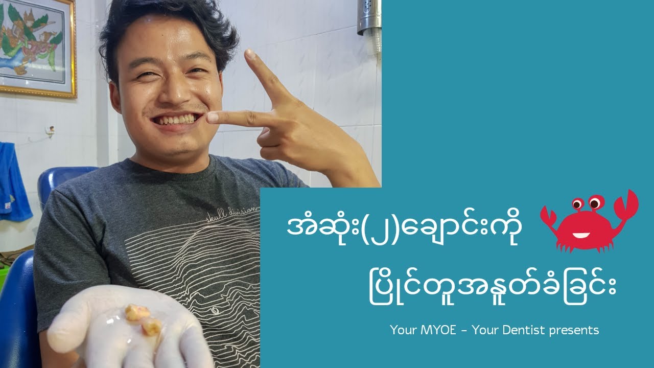 ကျွန်တော့်အံဆုံးတွေနုတ်တုန်းက အမှတ်တရများ