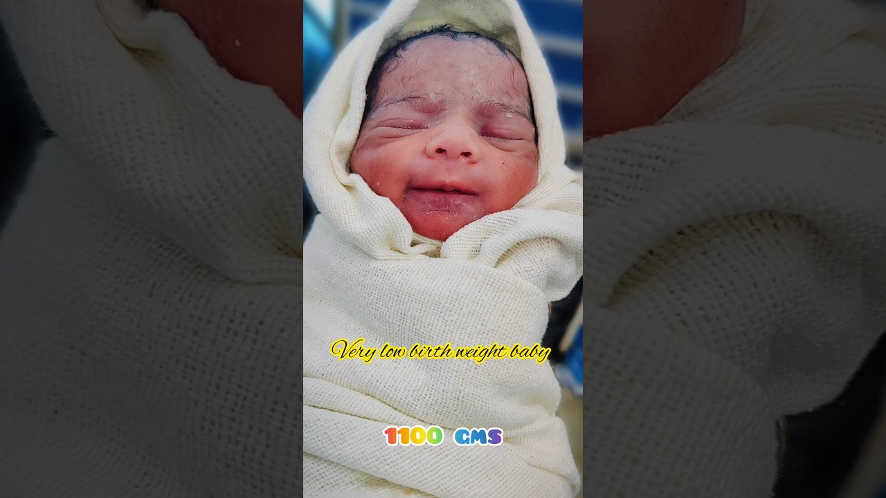 #pretermbaby #verylowbirthweightbaby#cutebaby