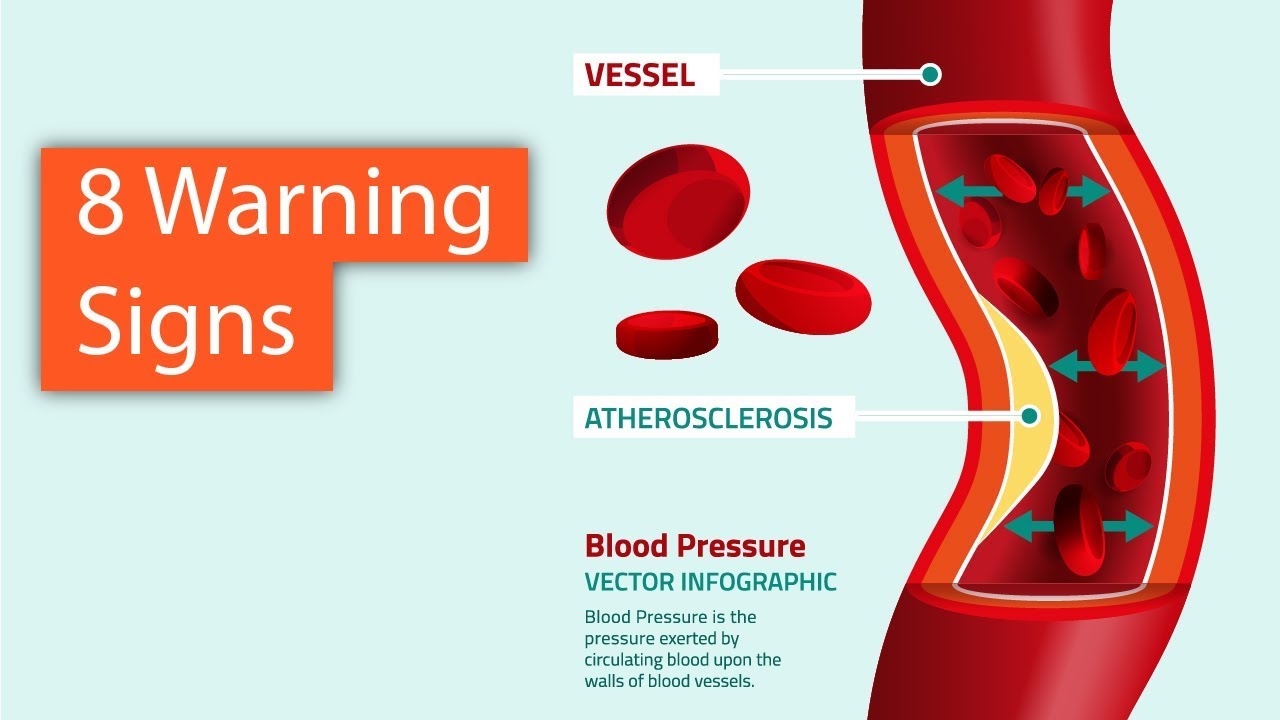 8 Warning Signs of Poor Blood Circulation