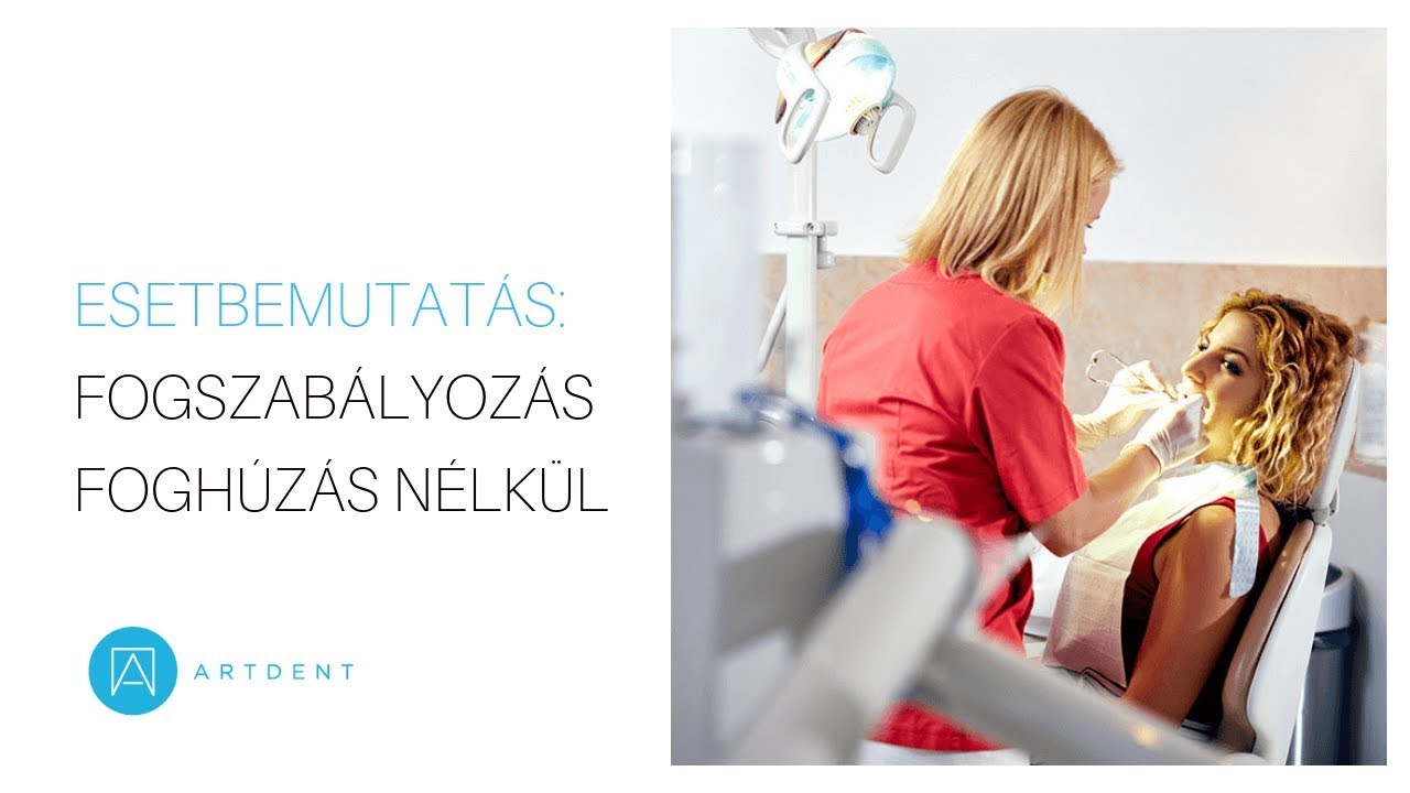 Fogszabályozás foghúzás nélkül  |  Esetbemutatás