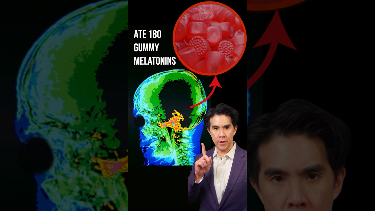 Crazy Gummy Melatonin Poisoning 🥴