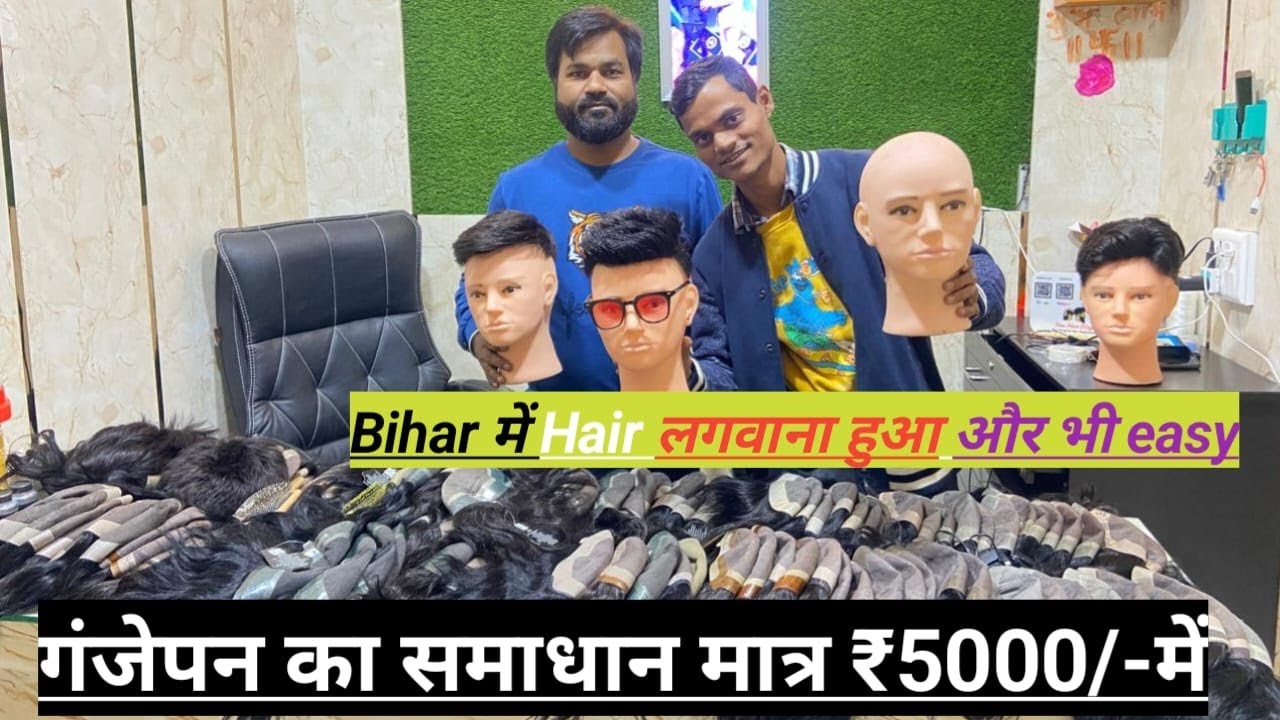 Hair Wig Hair Patch in Patna | Best Hair Wig Shop अब पटना में बिना surgery के 1 घंटा में बाल लगवाए😱