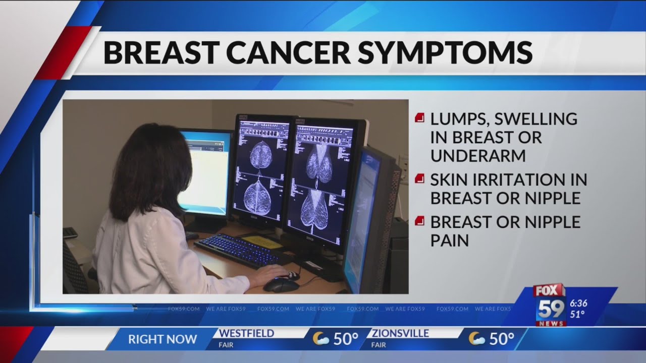 Local medical experts give insight on breast cancer risks, prevention