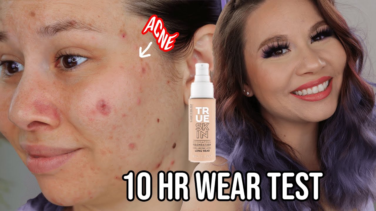Catrice True Skin Hydrating Foundation | 10 HR Wear test ACNE + DRY