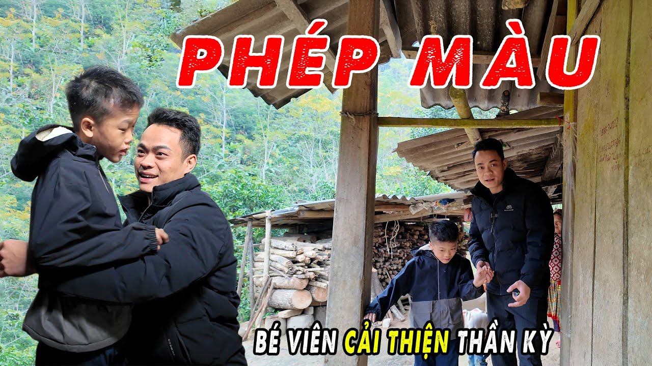 Tin Vui! Cậu Bé Người H’Mông Mắc Chứng Bệnh Lạ Đã Thay Đổi Hoàn Toàn Khiến Ai Cũng Ngỡ Ngàng