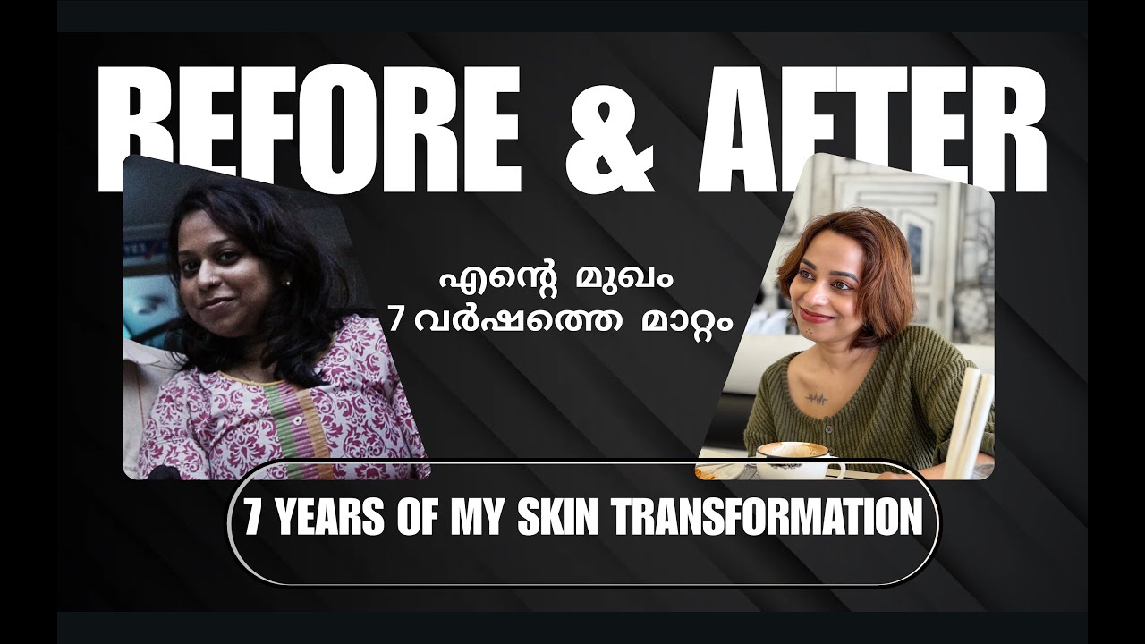 7 years skin transformation | ഏറ്റവും പവർഫുൾ ആയ സ്കിൻ കെയർ products | Skin Brightening | Skincare