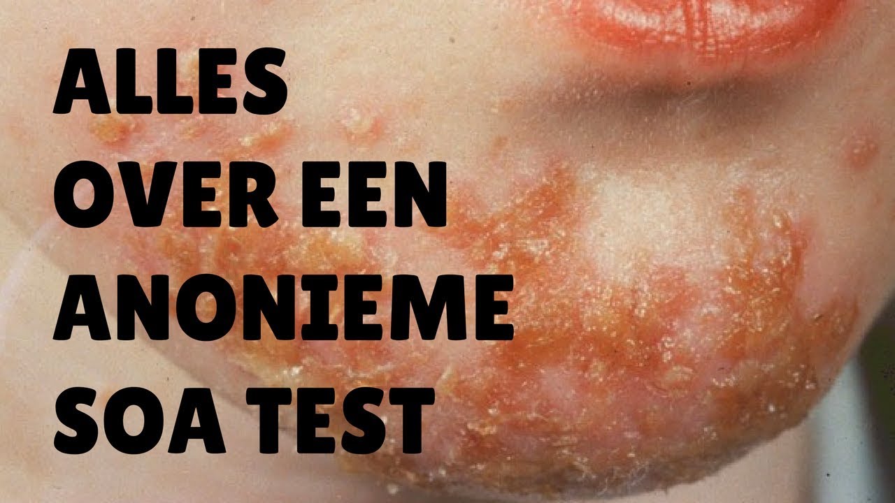 Alles Over Een Anonieme Soa Test | Hoe Gaat Een Soa-Test?