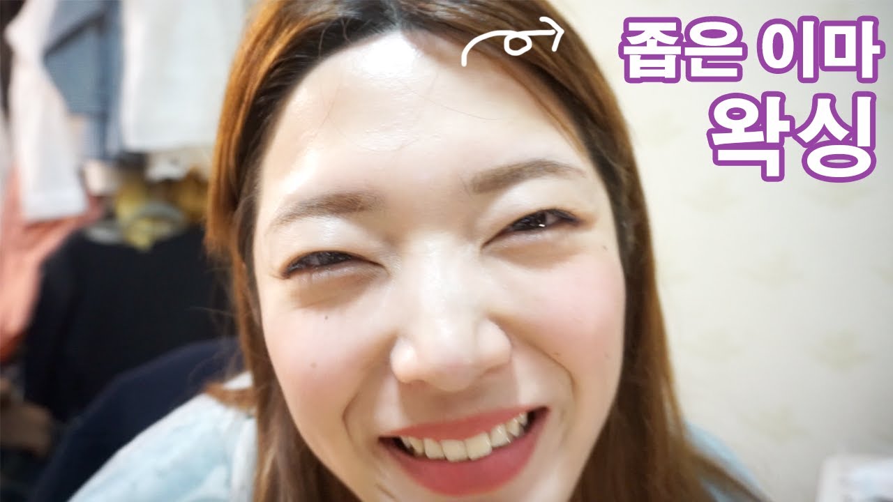 좁은이마 컴플렉스! 더 넓히고 옴+들뜸 없이 관리하는 법!