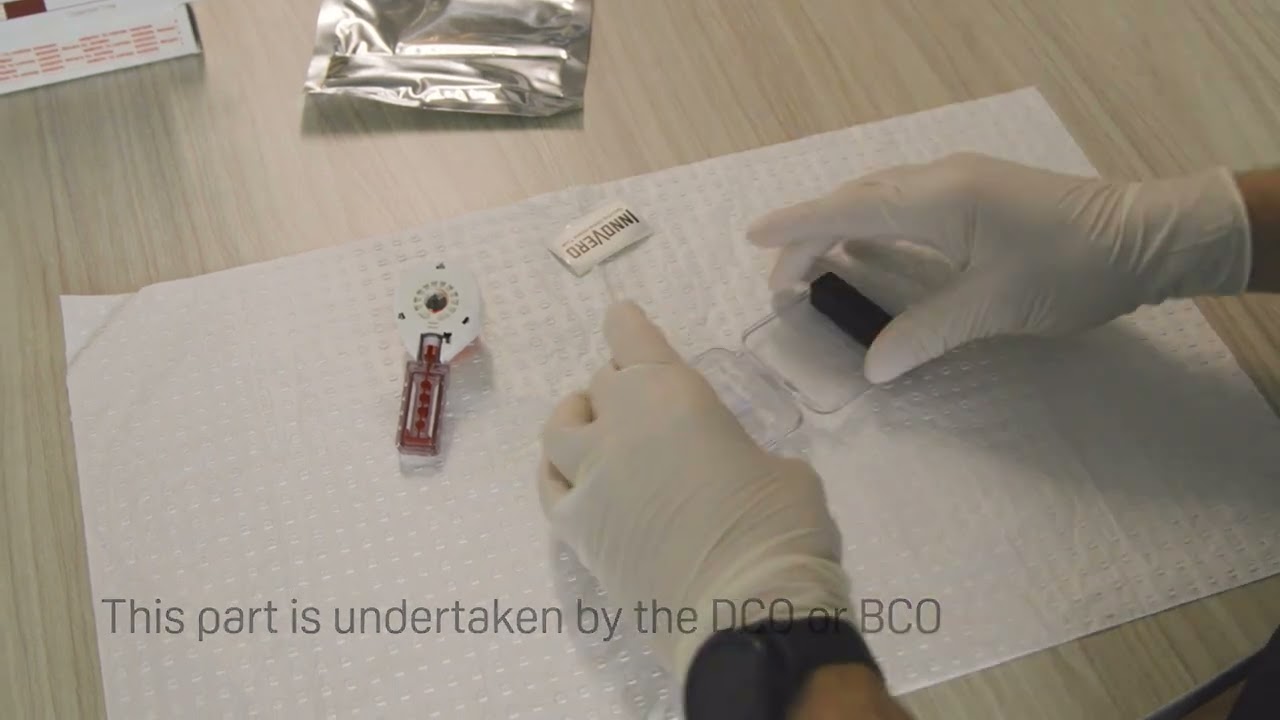 What to Expect - Dry Blood Spot Testing