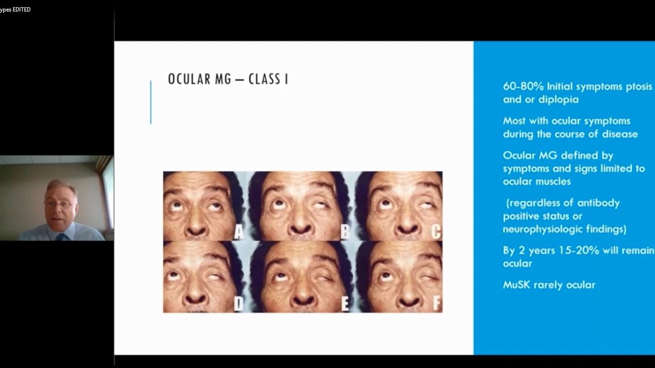 Myasthenia Gravis Subtypes