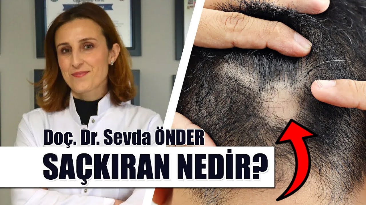 Saçkıran hastalığı nedir? | Saçkıran ve sakal kıran nasıl tedavi edilir? | Doç. Dr. Sevda ÖNDER