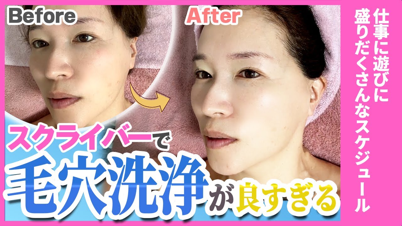毛穴汚れゼロへ！プロの洗浄テクが凄い…驚きの変化に注目✨