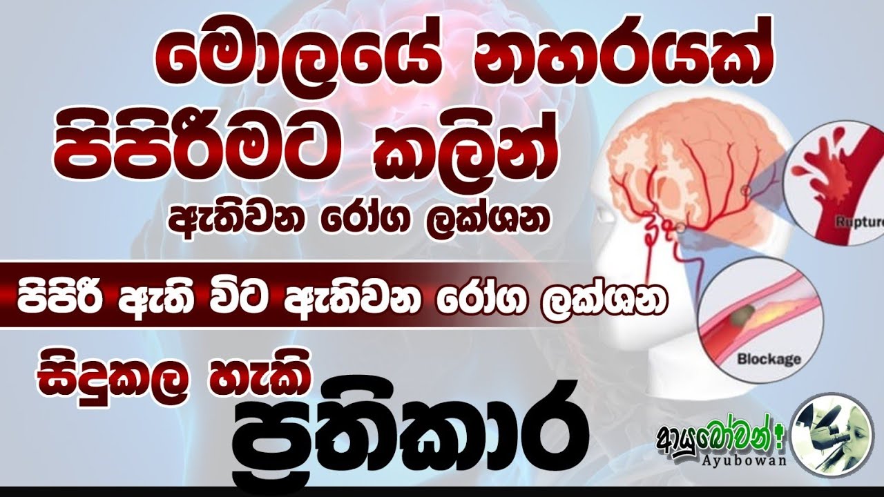 මොලයේ නහරයක් පිපිරීමට කලින් ඇතිවන රෝග ලක්ෂන , පිපිරී ඇති විට ඇතිවන රෝග ලක්ෂන , සිදුකල හැකි ප්‍රතිකාර
