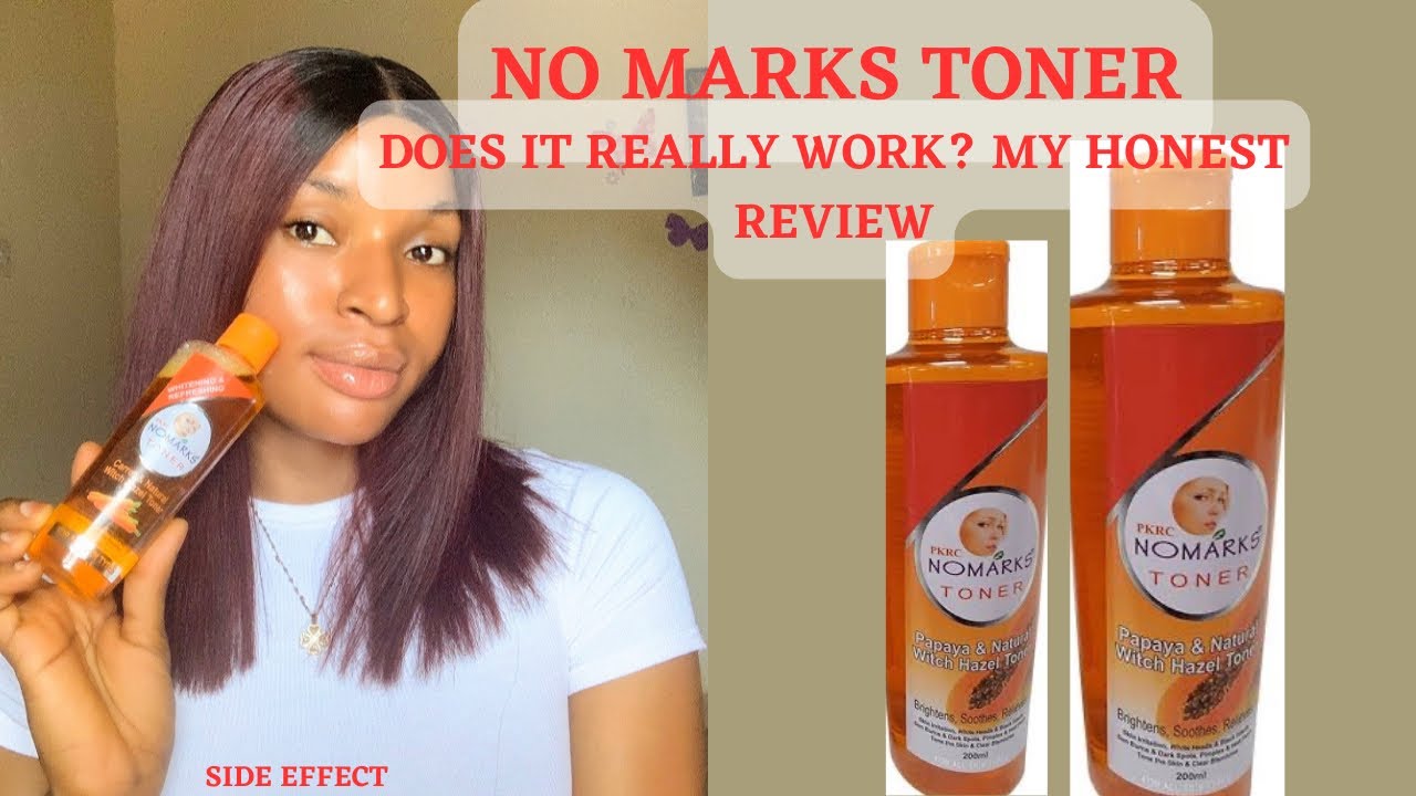 NO MARKS TONER REVIEW / My Honest Review And Side Effect