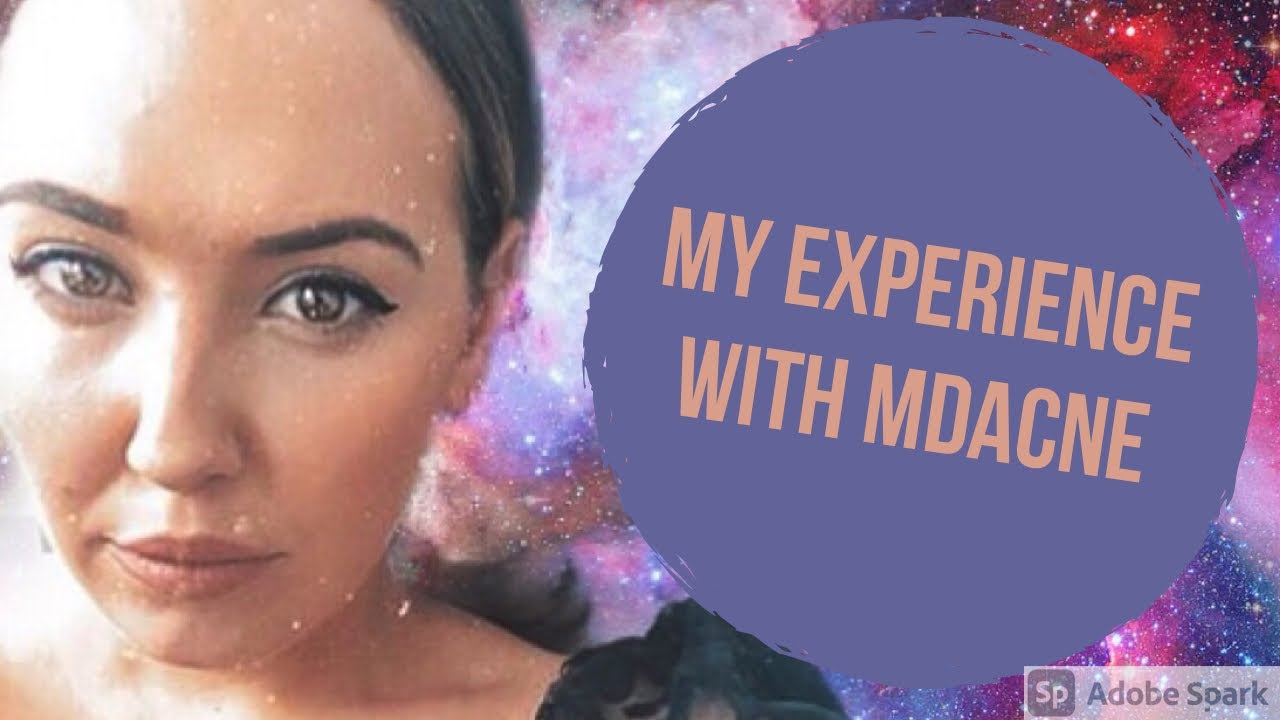 An Honest Review of MDACNE