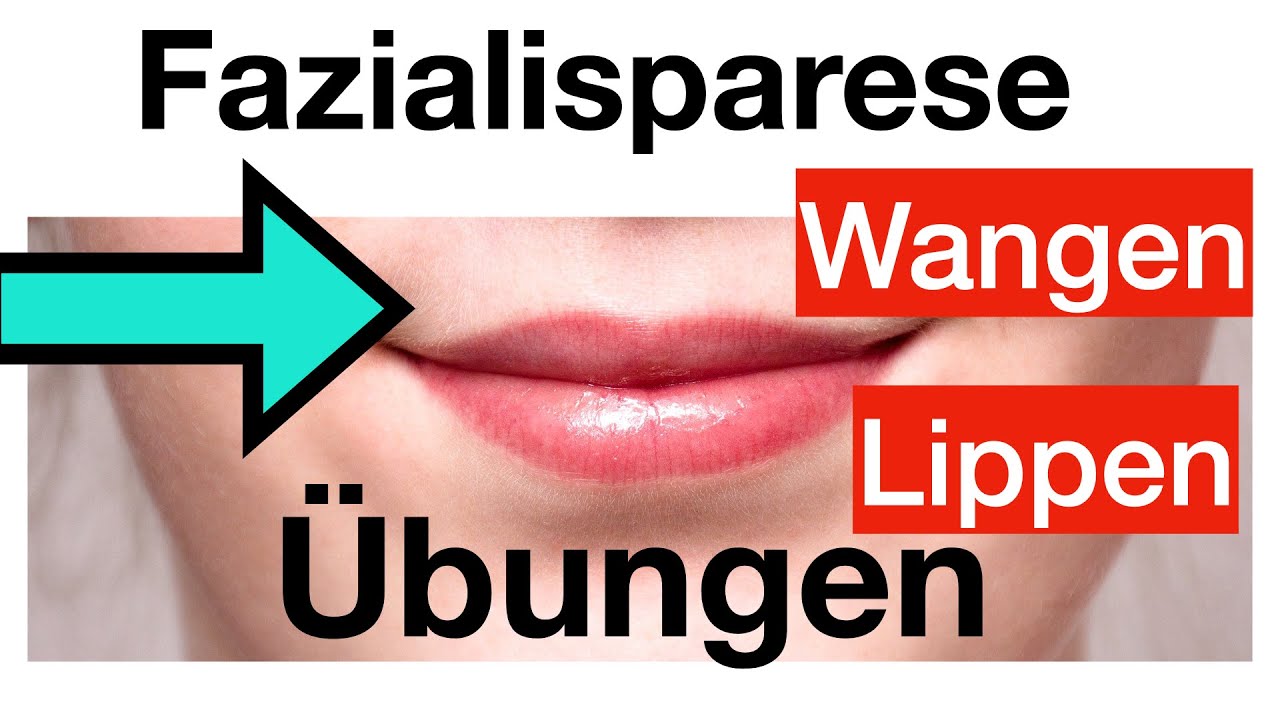 Gesichtslähmung verbessern, 4 Übungen für Lippen + Wangen,  Fazialisparese, Anfänger,Dehnungen