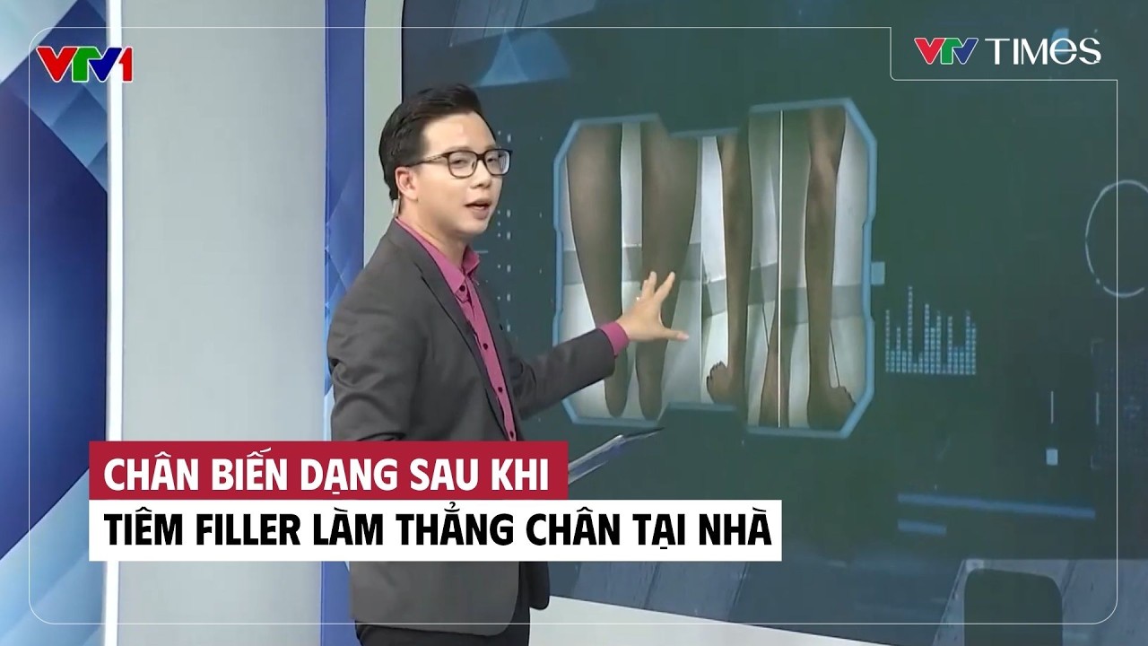 Chân biến dạng sau khi tiêm filler làm thẳng chân tại nhà | Cụm tin | VTV Times