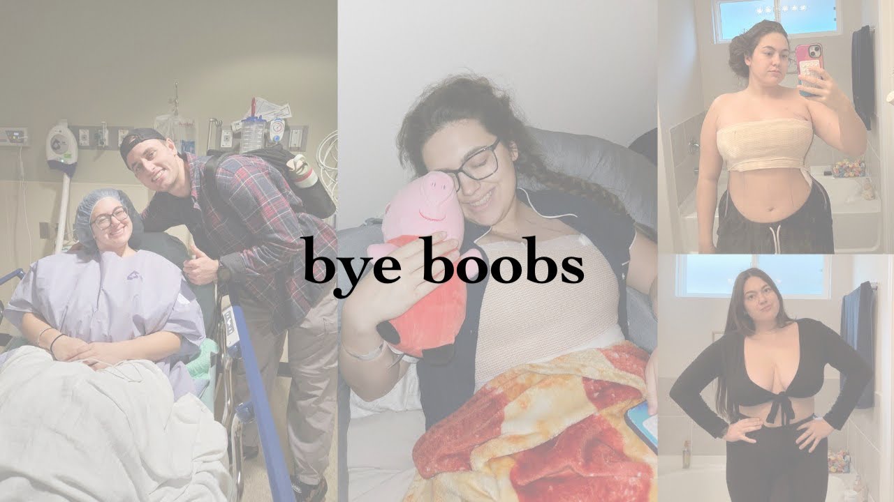 what they dont tell you about getting a breast reduction / my reduction vlog with before & afters
