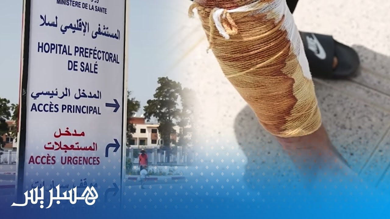 ضعف الخدمات الصحية يفاقم معاناة وآلام المرضى بمدينة سلا