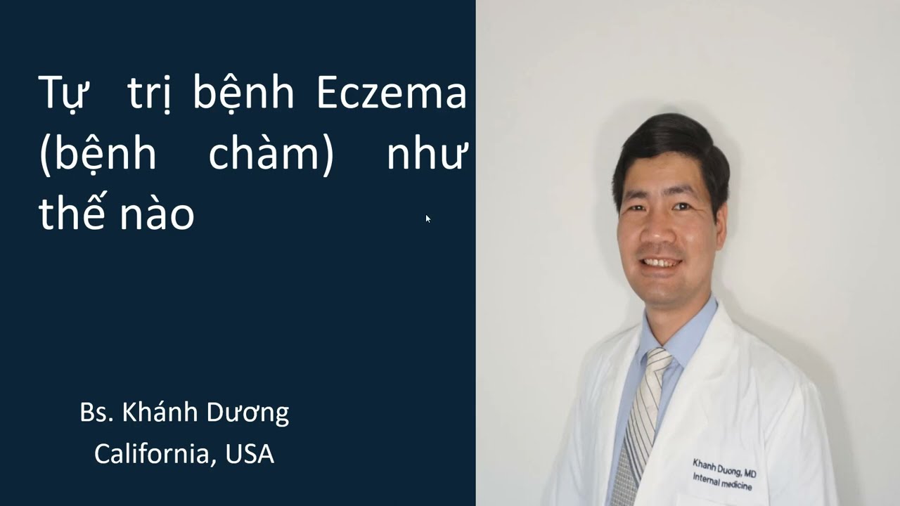 Tự trị bệnh chàm như thế nào (Bệnh eczema, bệnh viêm da cơ địa) - Bs. Khánh Dương