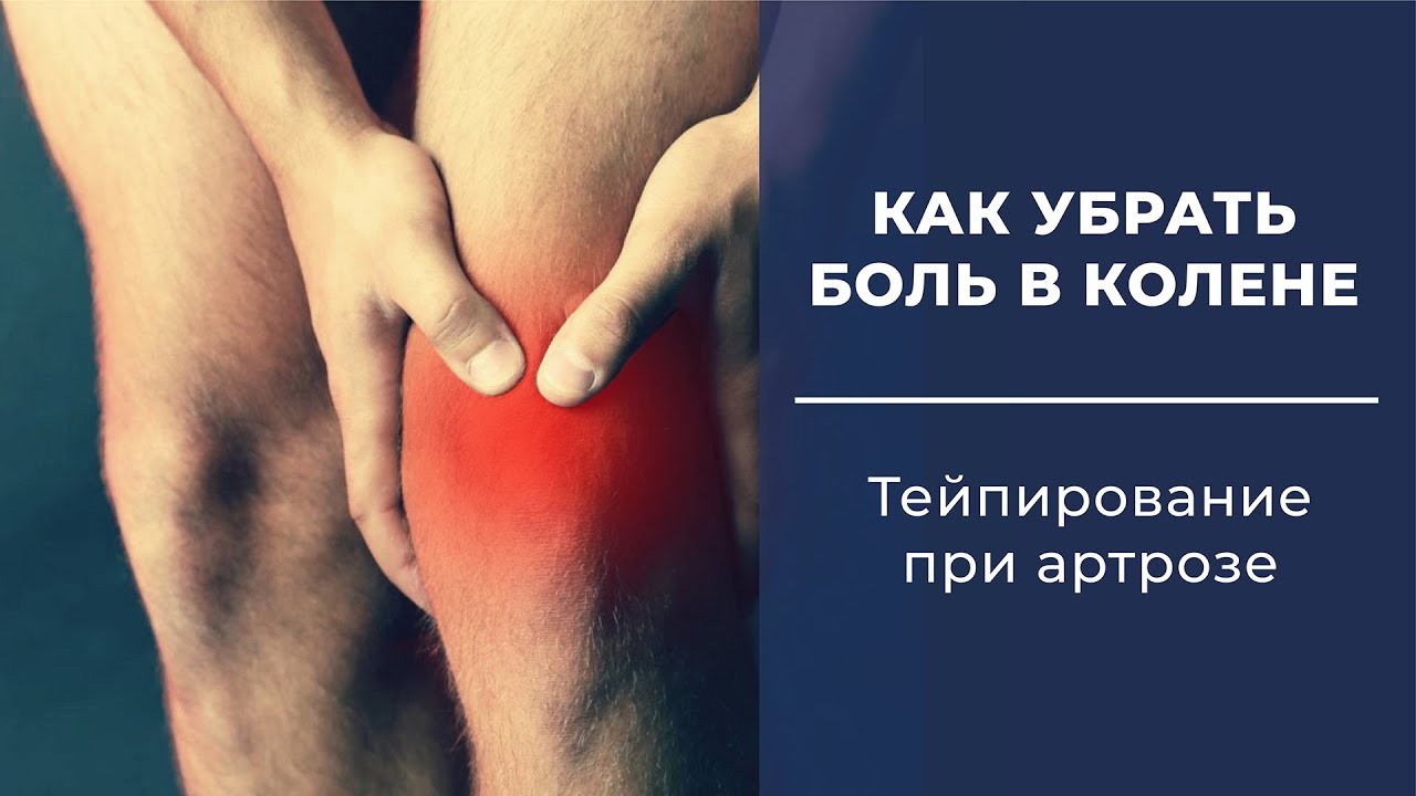 ✅Как убрать боль в колене? Тейпирование колена. Тейпирование при артрозе. Артроз колена.