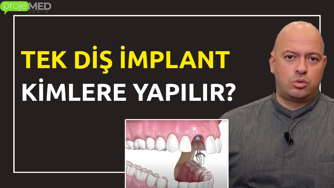Tek Diş İmplant Nedir ve Nasıl Yapılır? | Tek Diş İmplant Kimlere Yapılır?