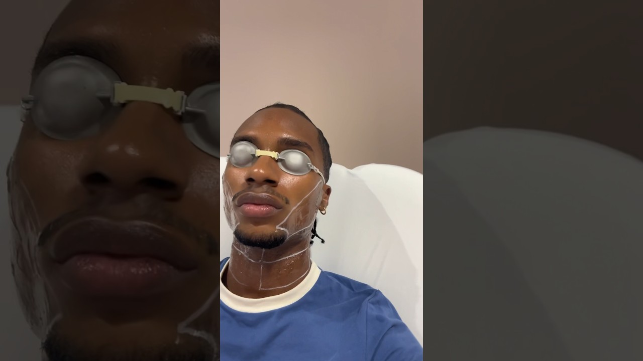 THIS IS YOUR SIGN TO GET LASER HAIR REMOVAL | Black Men
