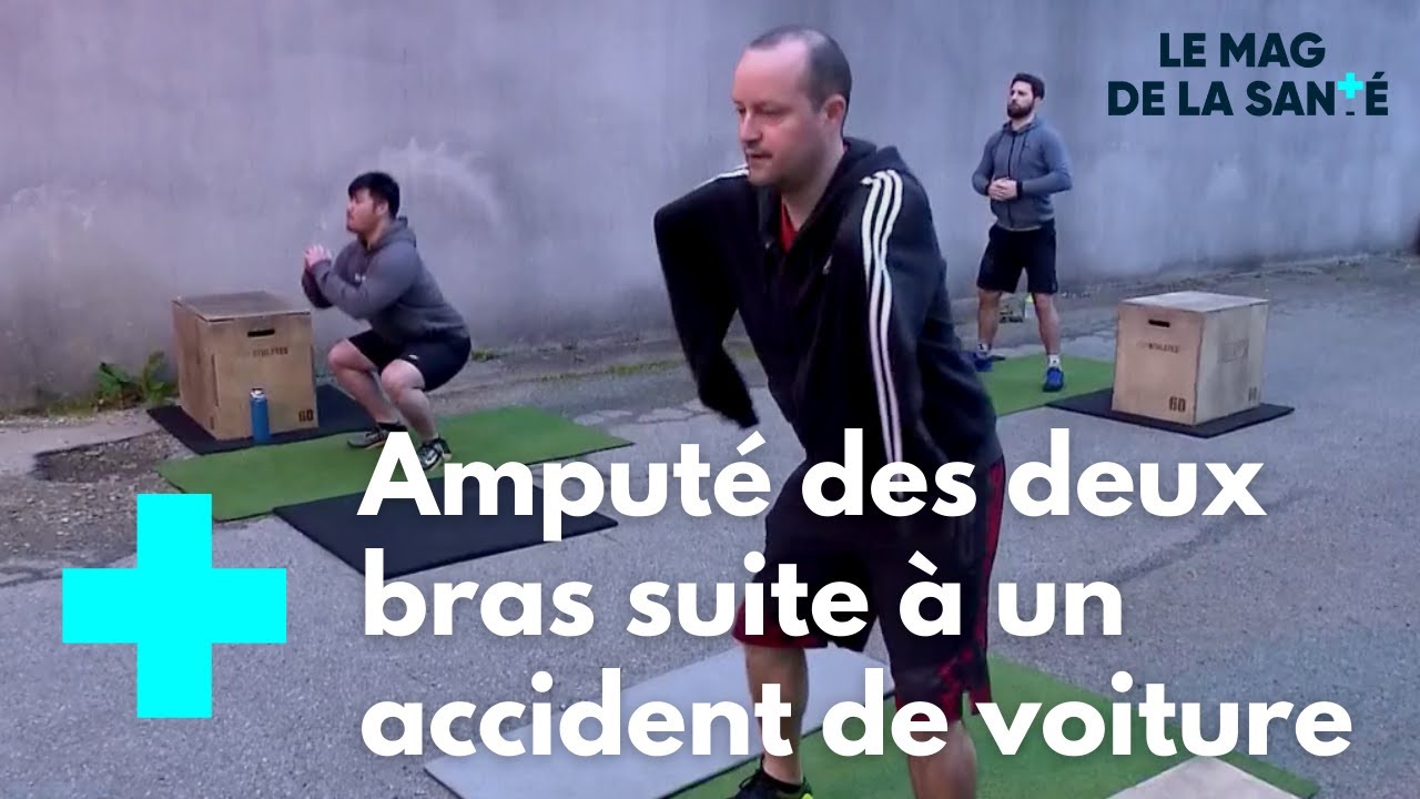 Bras bioniques : les prothèses du futur 1/5 - Le Magazine de la Santé